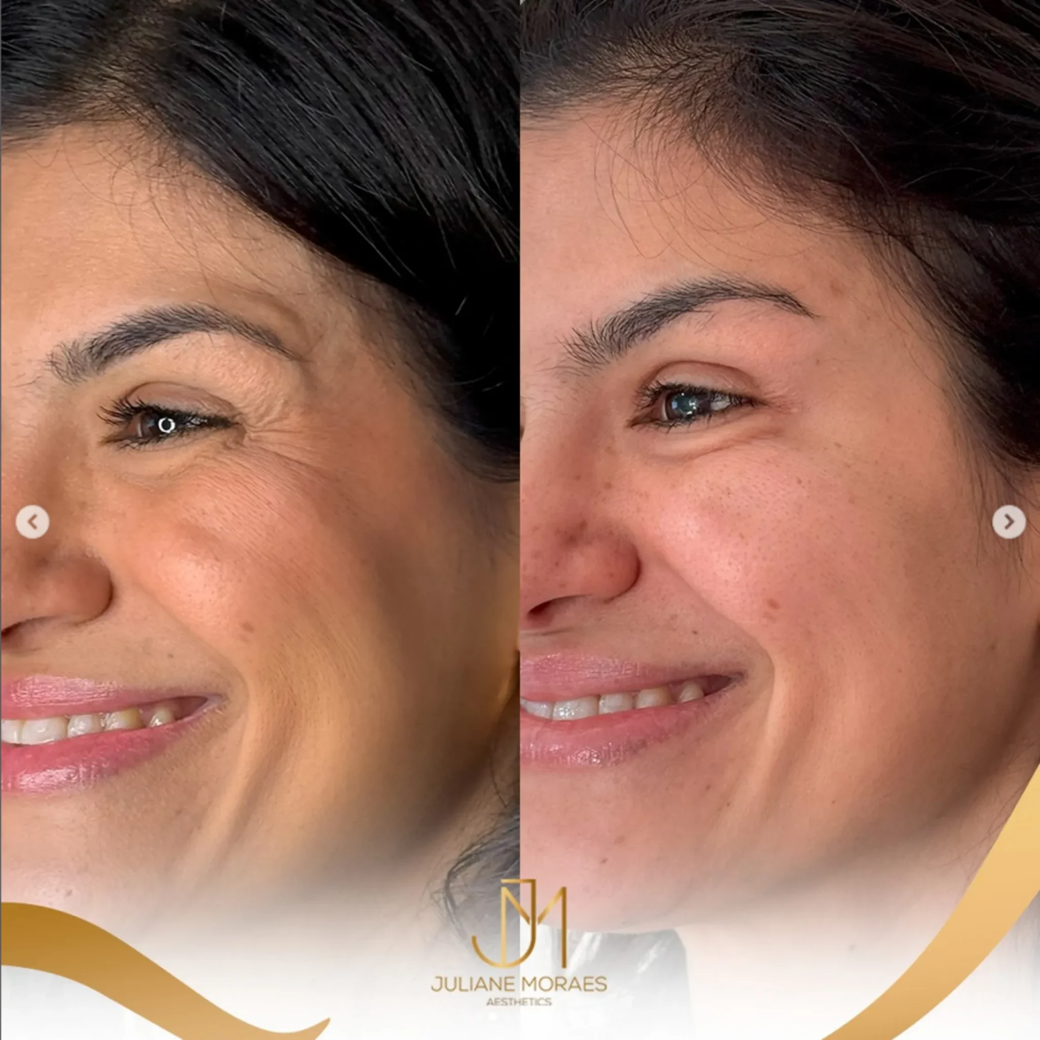 Design sem nome (63)_11zon