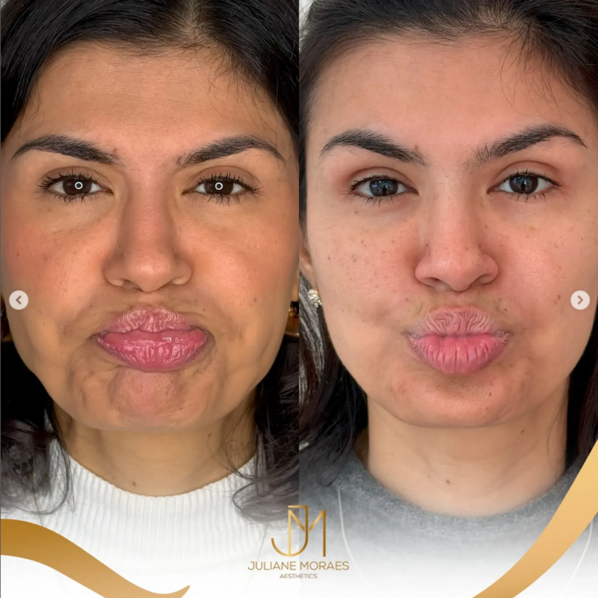 Design sem nome (64)_11zon