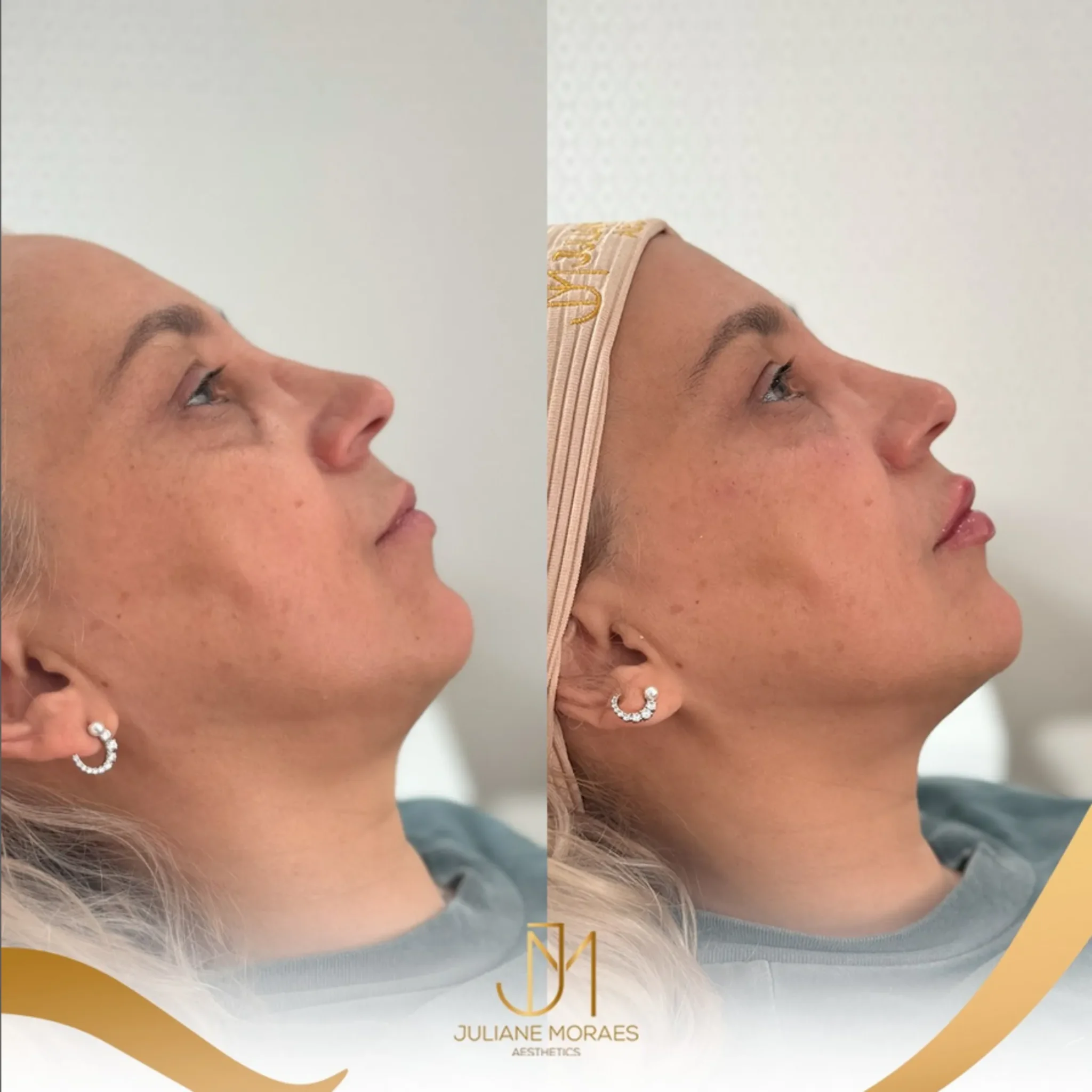 Design sem nome (69)_11zon