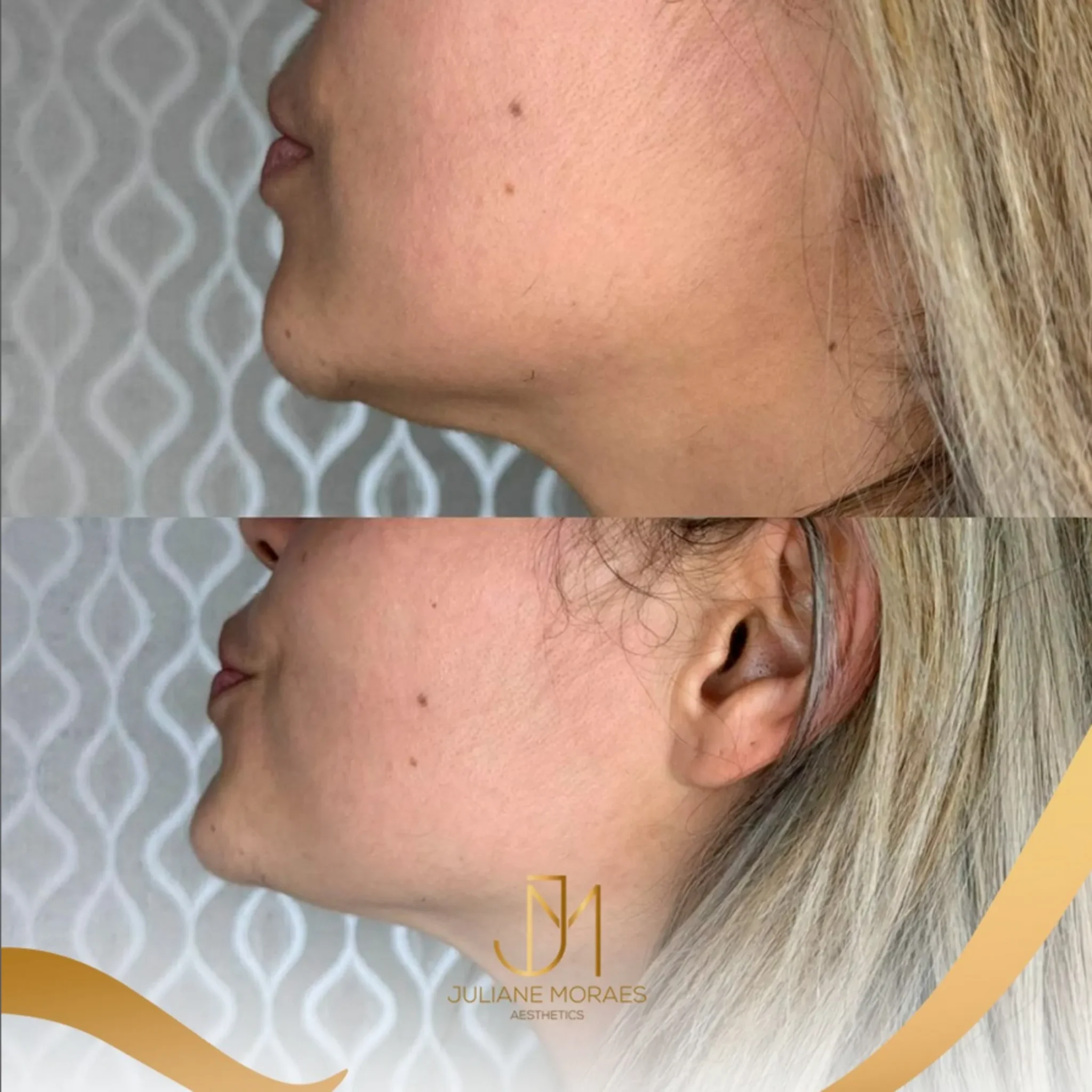 Design sem nome (72)_11zon