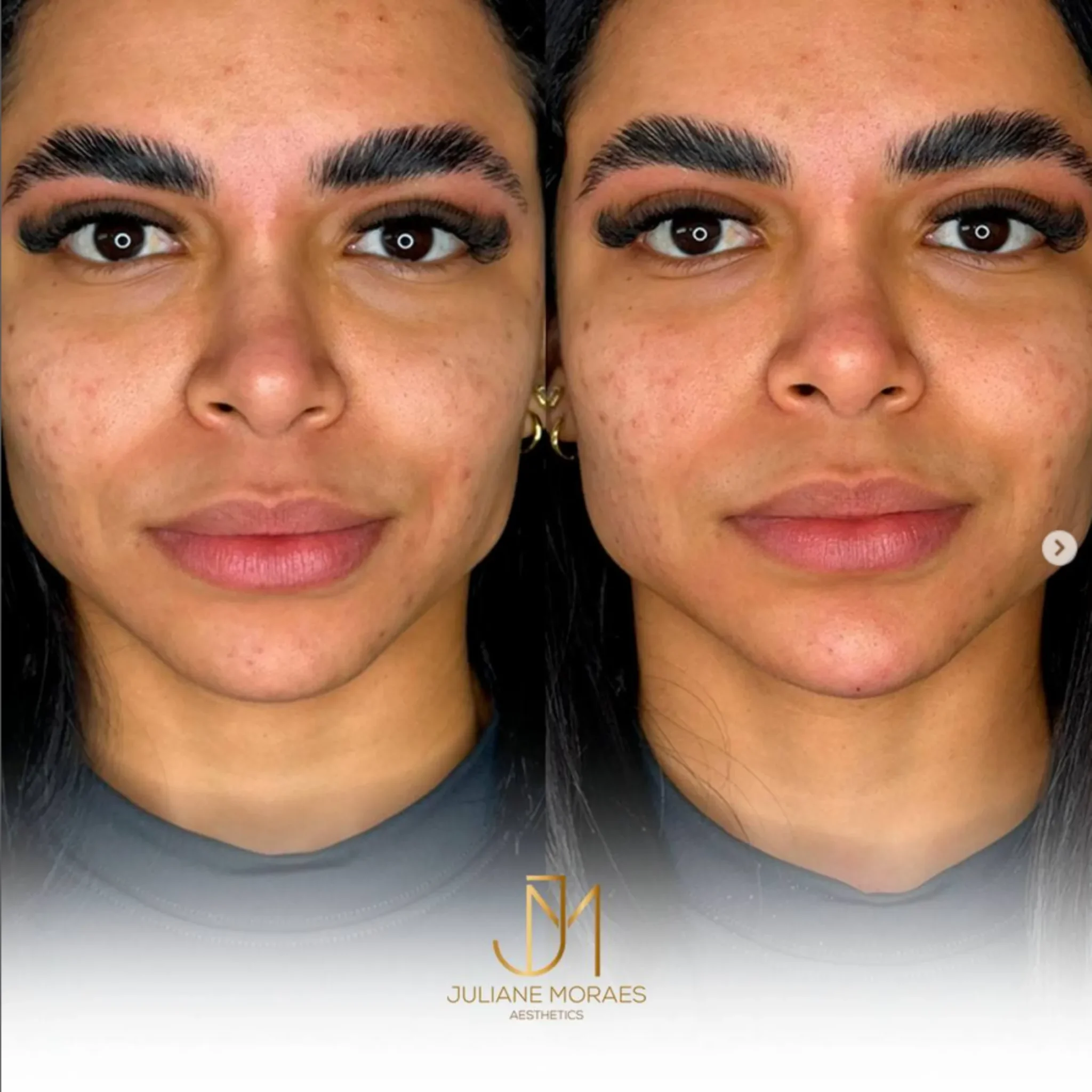 Design sem nome (73)_11zon